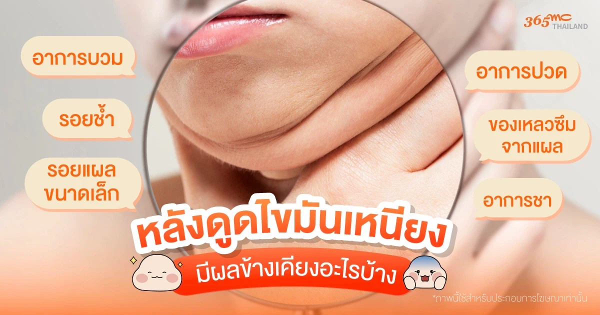 ดูดไขมันเหนียง ข้อเสีย