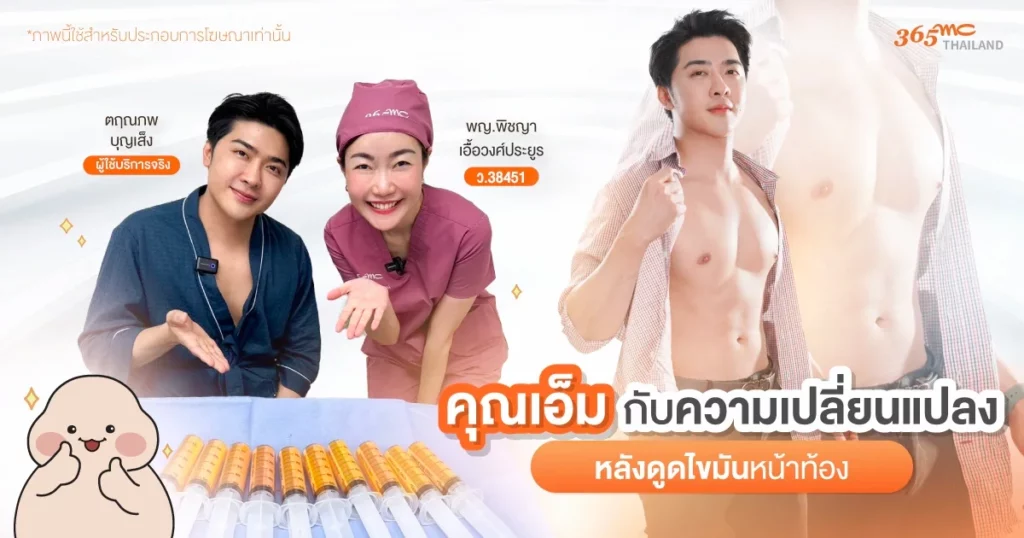 รีวิวดูดไขมันหน้าท้อง