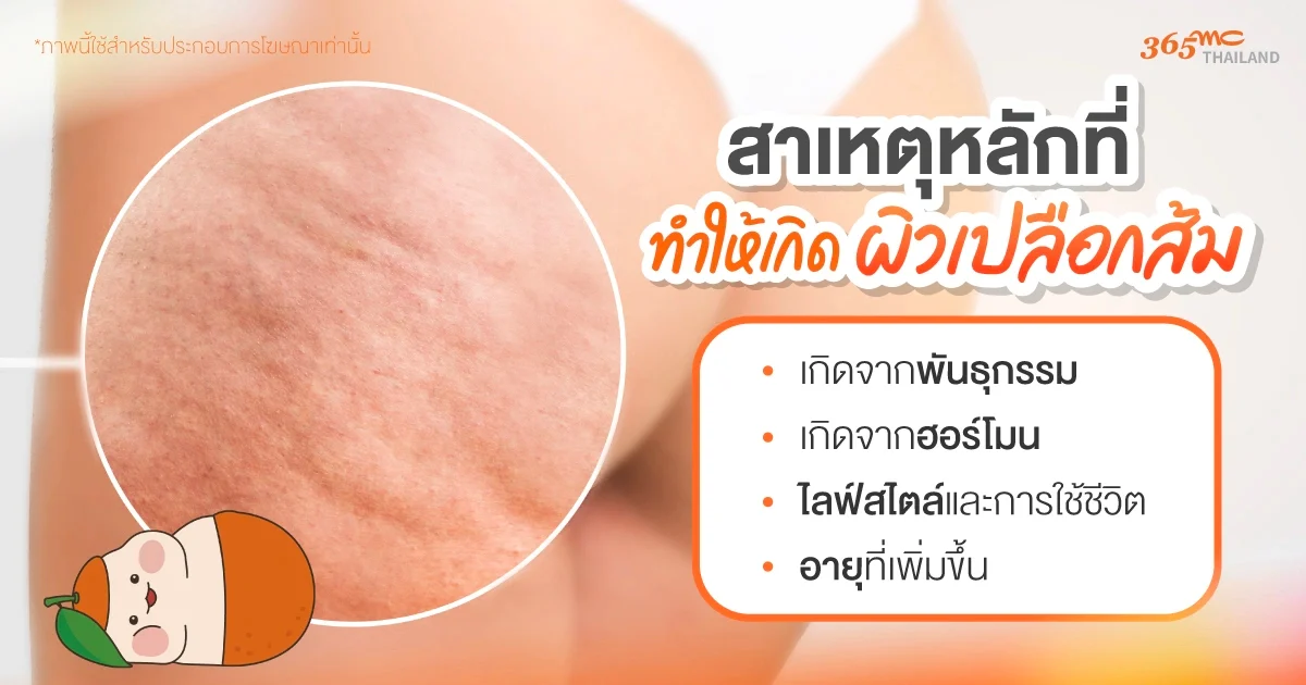 สาเหตุ ผิวเปลือกส้ม