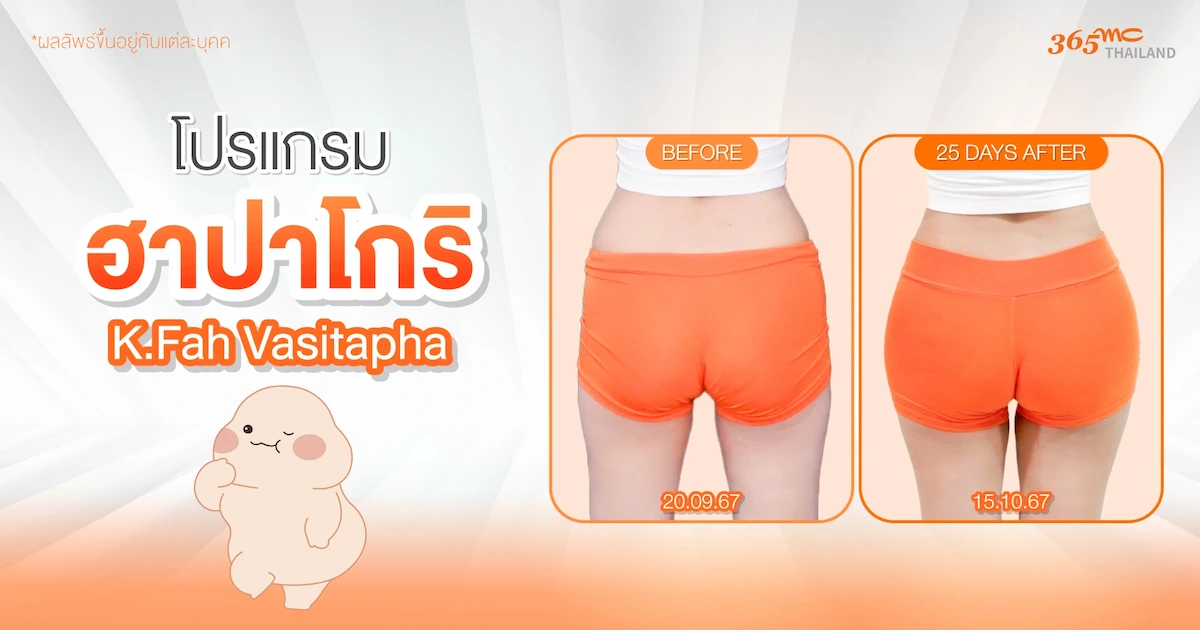 รีวิวเติมสะโพก ฮาปาโกริ