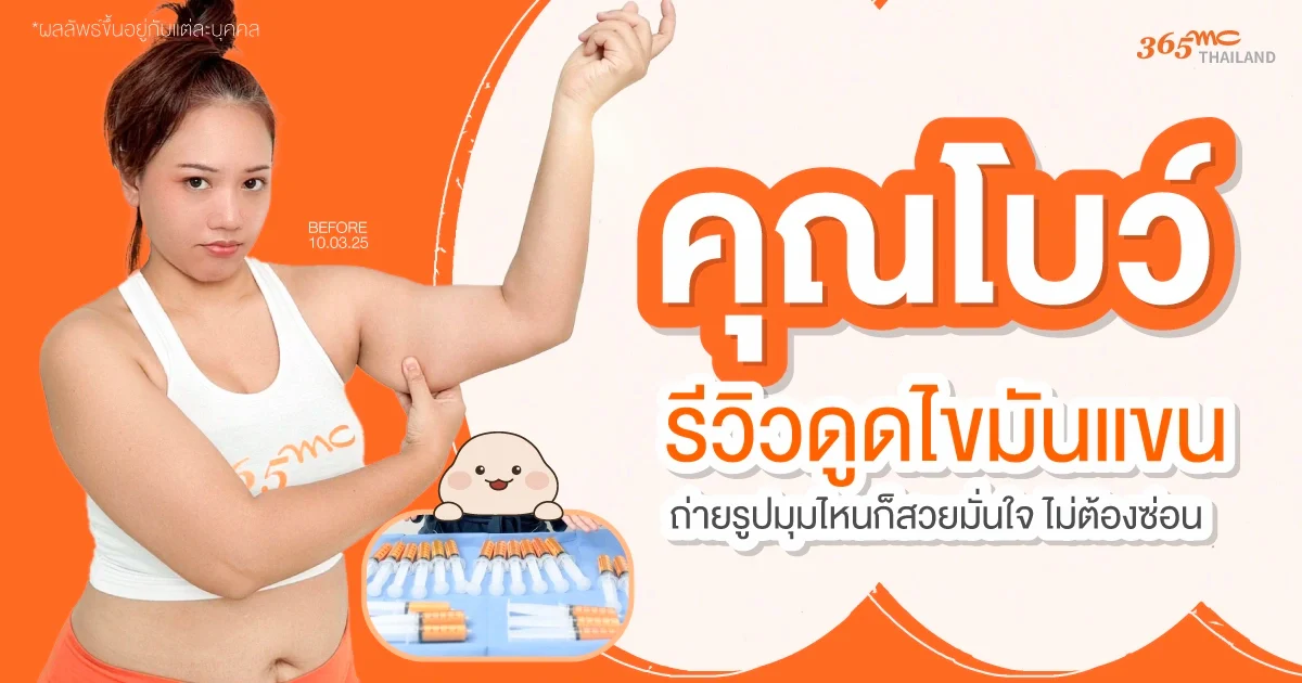 รีวิวดูดไขมันแขน