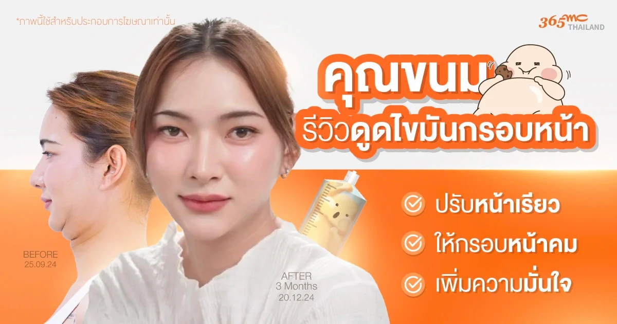 รีวิวดูดไขมันกรอบหน้า จากคุณขนม