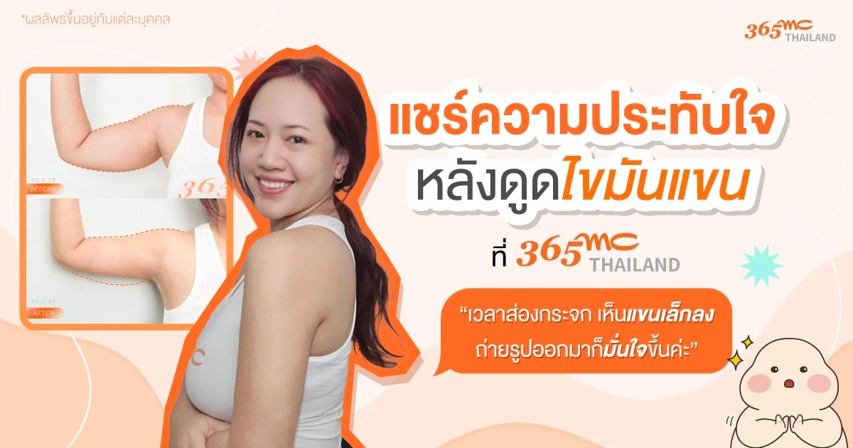 รีวิวดูดไขมันแขน โปรแกรม LAMS