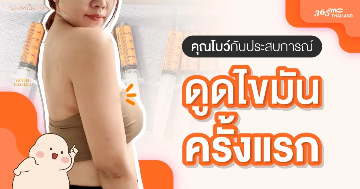 รีวิวดูดไขมันแขนครั้งแรก