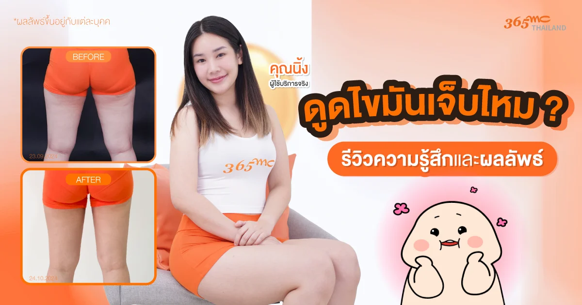 รีวิว ดูดไขมัน