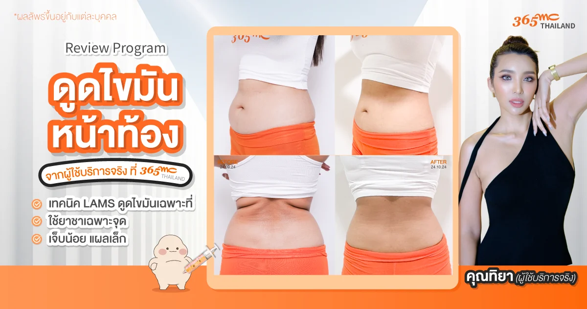 โปรแกรมลดน้ำหนัก มีอะไรบ้าง