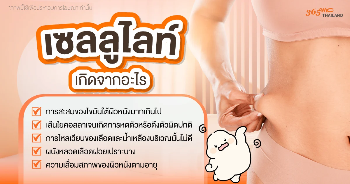 เซลลูไลท์ เกิดจากอะไร