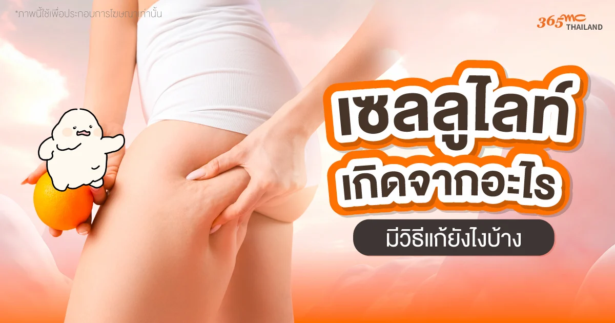 เซลลูไลท์ เกิดจากอะไร มีวิธีแก้ยังไงบ้าง