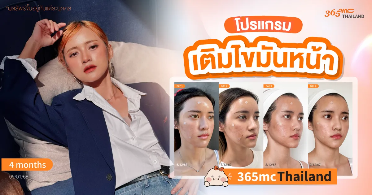 เติมไขมันหน้า รีวิว