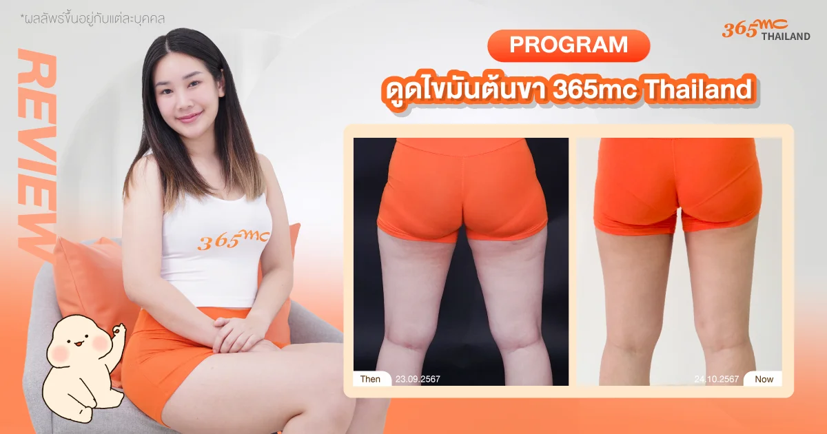 รีวิวดูดไขมันต้นขา
