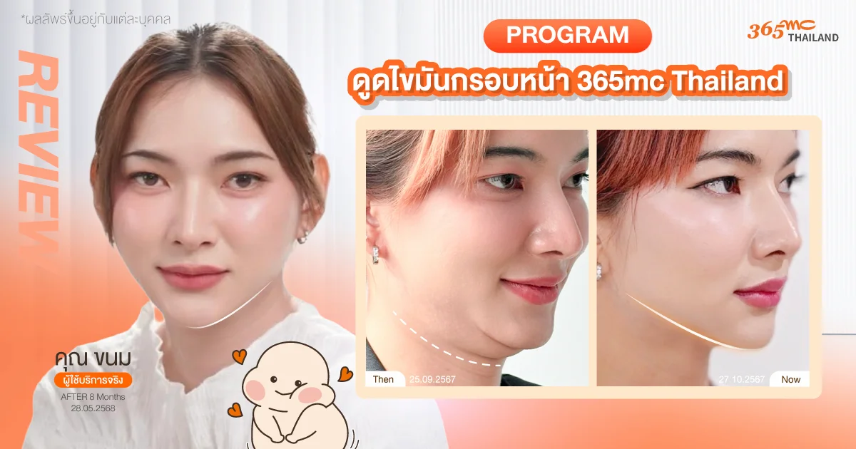 รีวิวดูดไขมันกรอบหน้า