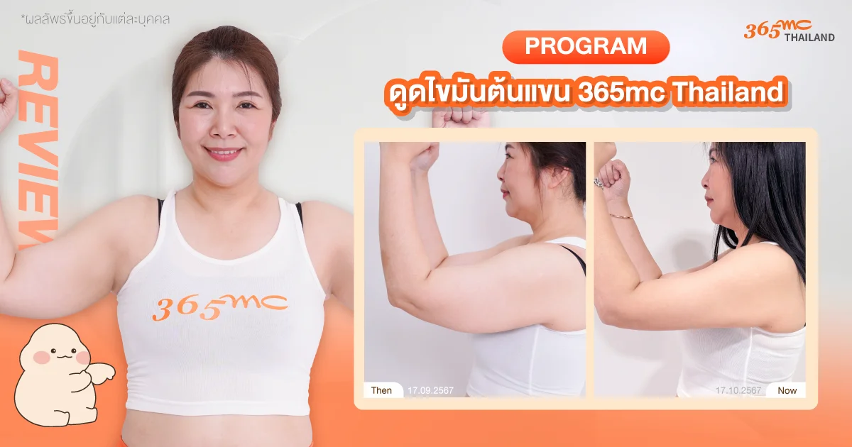 รีวิวดูดไขมันต้นแขน
