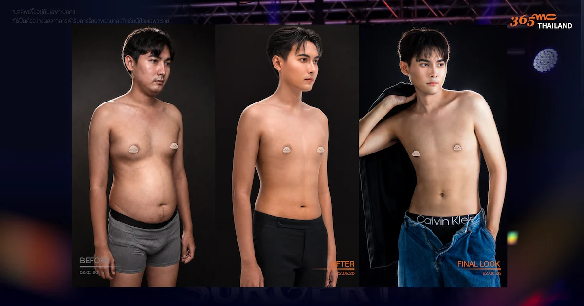  ภาพคุณอดัม Before After Final Look