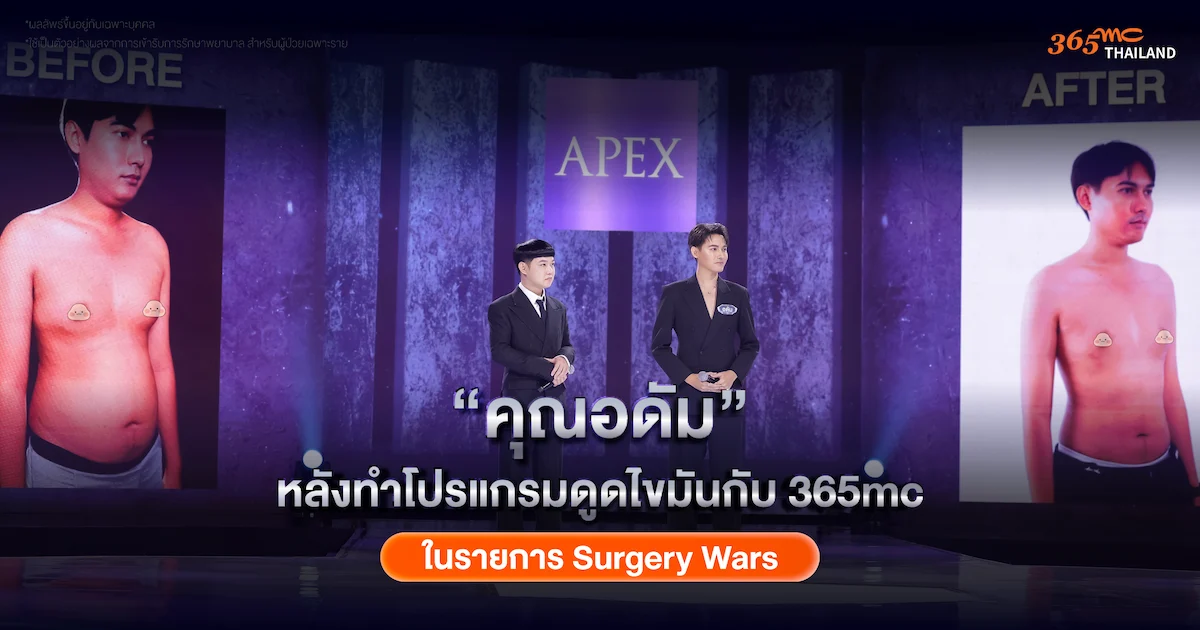 ภาพคุณอดัม หลังดูดไขมัน Before After